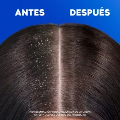 Apple Fresh Shampoing Antipelliculaires 2en1