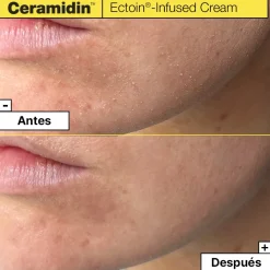Ceramidin Ectoin Infused Cream