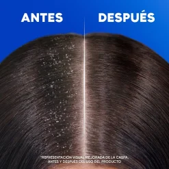 Classic Shampoing Antipelliculaire