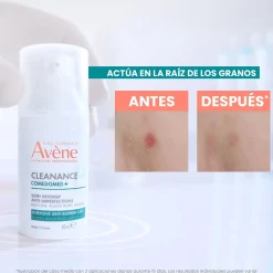 Cleanance Concentré Anti-Imperfections