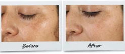 Clearly Corrective™ Dark Spot Solution - Sérum Éclaircissant Anti-Taches
