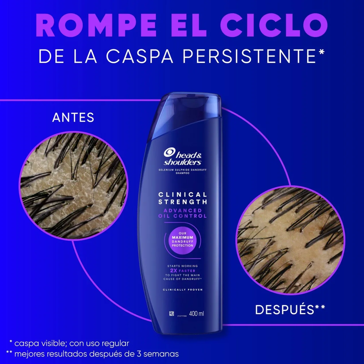 Clinical Strength Shampoing Detox