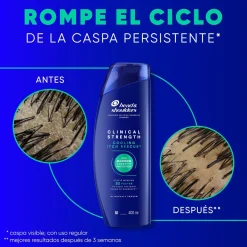 Clinical Strength Shampoing Soulagement des Démangeaisons