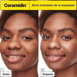 Céramidine Crème Hydratante
