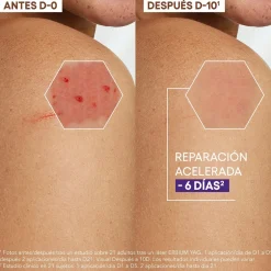 Crème Réparatrice Apaisante Epitheliale A.H Ultra
