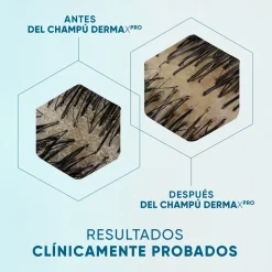 Dermaxpro Shampoing Apaisant Antipelliculaire