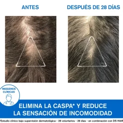 DS Hair Shampoing Anti-pelliculaire