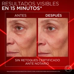 Effaceur Instantané de Poches Revitalift Laser