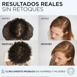 Elvive Growth Booster Après-shampoing Anti-chute