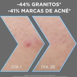 Garnier Sérum Anti-Imperfections + 4 % de Niacinamide