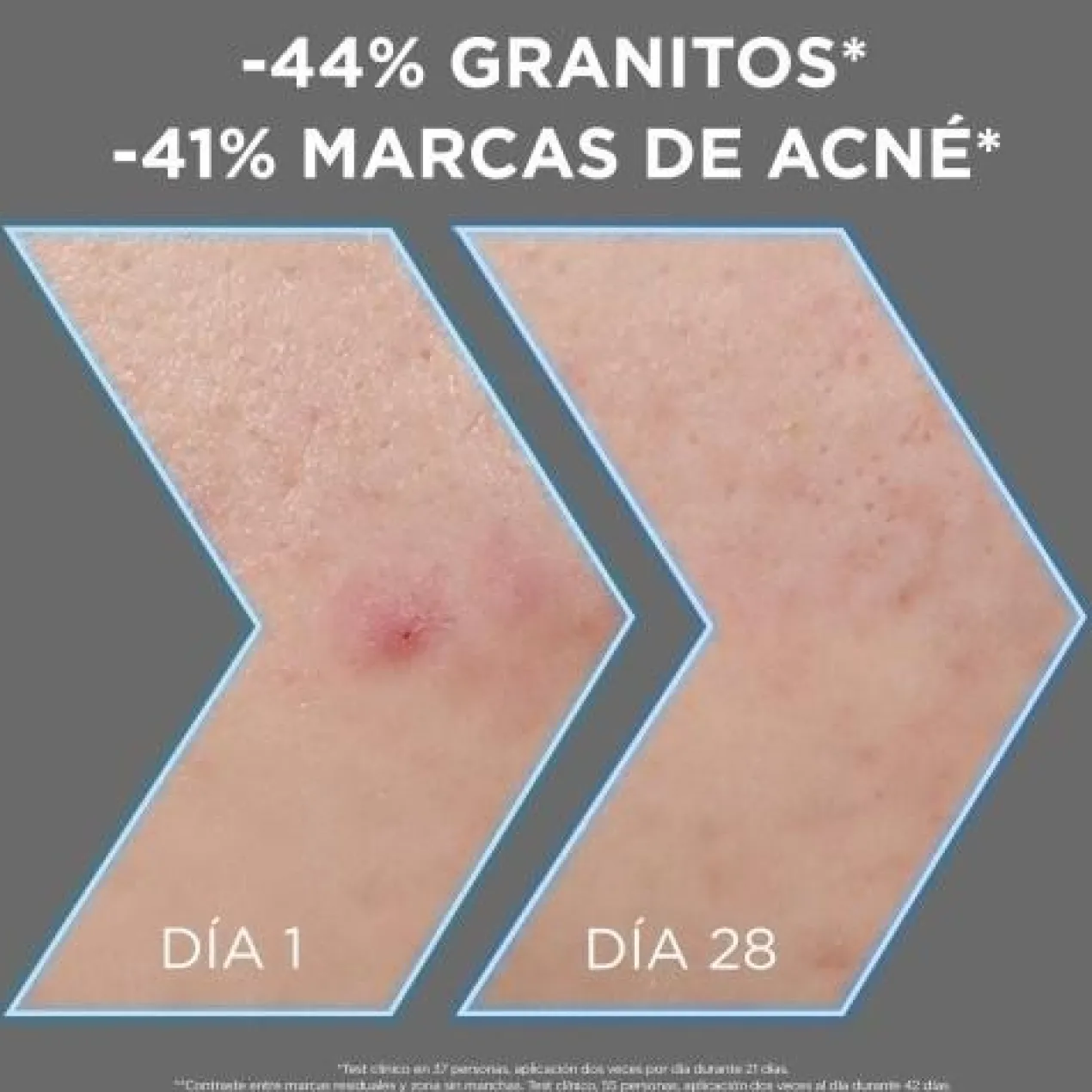 Garnier Sérum Anti-Imperfections + 4 % de Niacinamide
