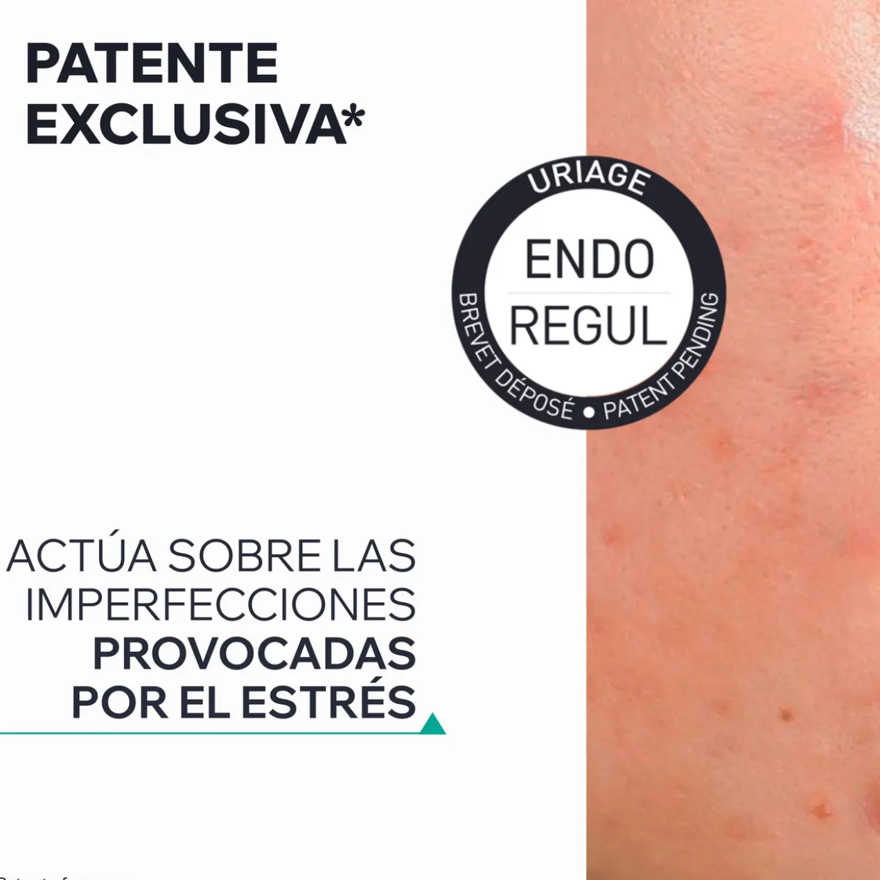 Hyseac Sérum Booster Anti-Imperfections