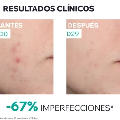 Hyseac Sérum Booster Anti-Imperfections