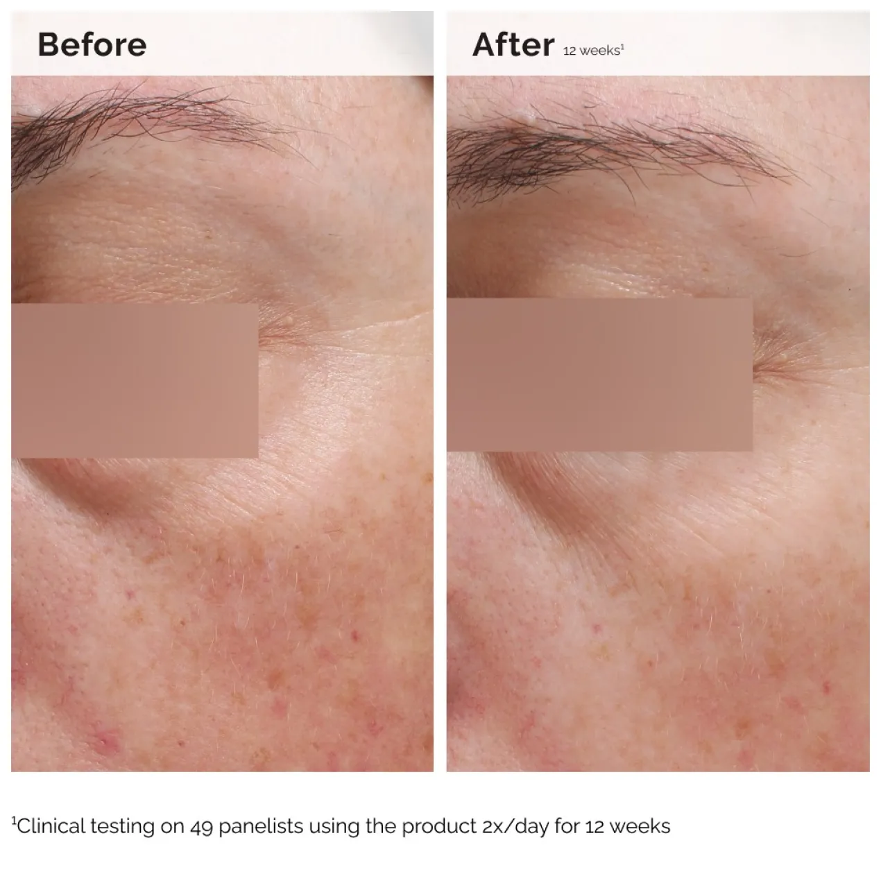 Niacinamide 5% Face & Body Emulsion