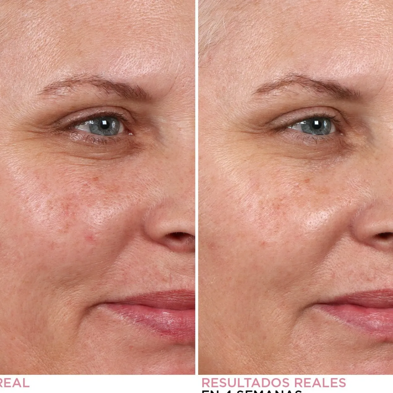 Peeling de Nuit Hello Results Baby