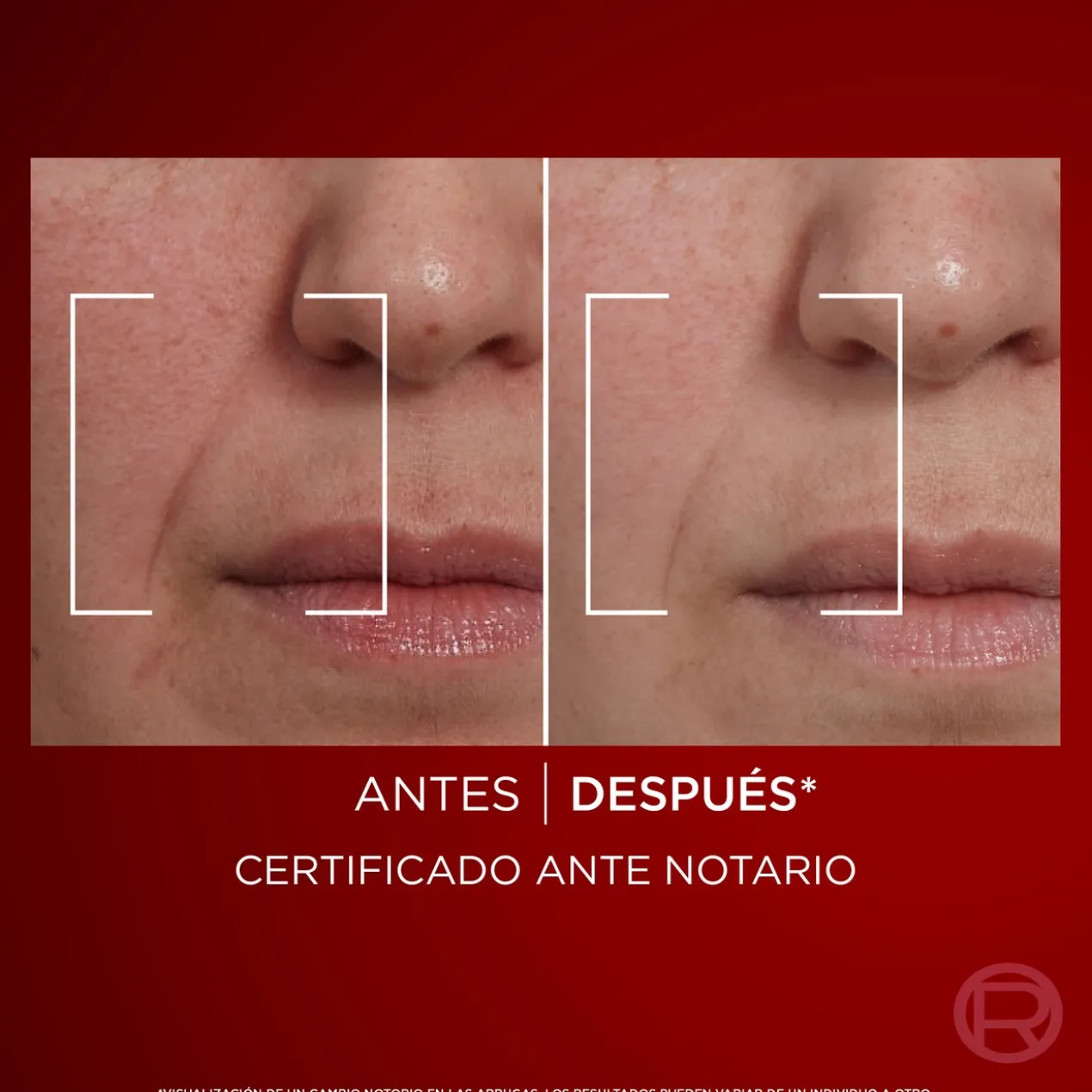 Revitalift Laser Jour