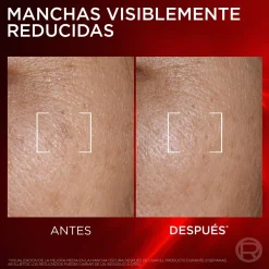 Revitalift Laser Sérum Anti-Âge