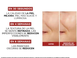 Revitalift Peeling Toner en Acide Glycolique 5%