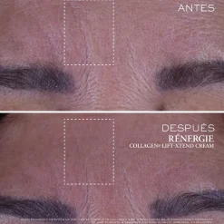 Rénergie Collagen Lift-Xtend Cream