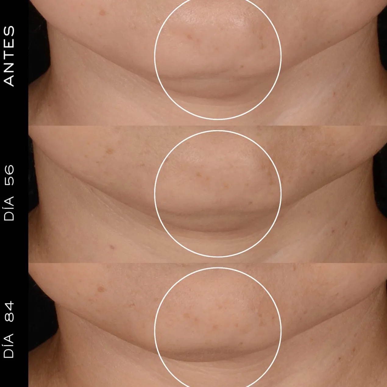 Rénergie H.P.N. 300 - Crème Régénératrice aux Peptides
