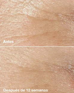 Smart Clinical Repair Wrinkle Correcting Crème Anti-rides