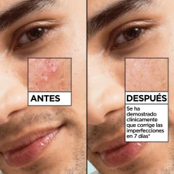 Sérum Anti-Imperfections au Salicylique Skin Active