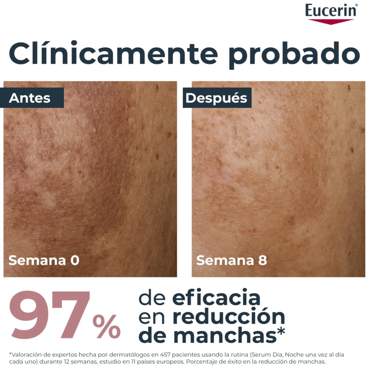 Sérum Anti-Taches Dual Anti-Pigment