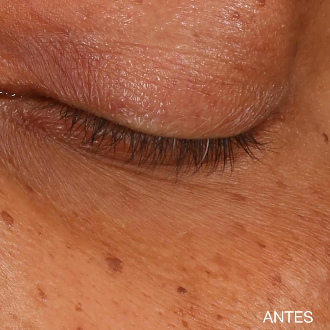 Sérum Concentré Illuminateur pour le Contour des Yeux
