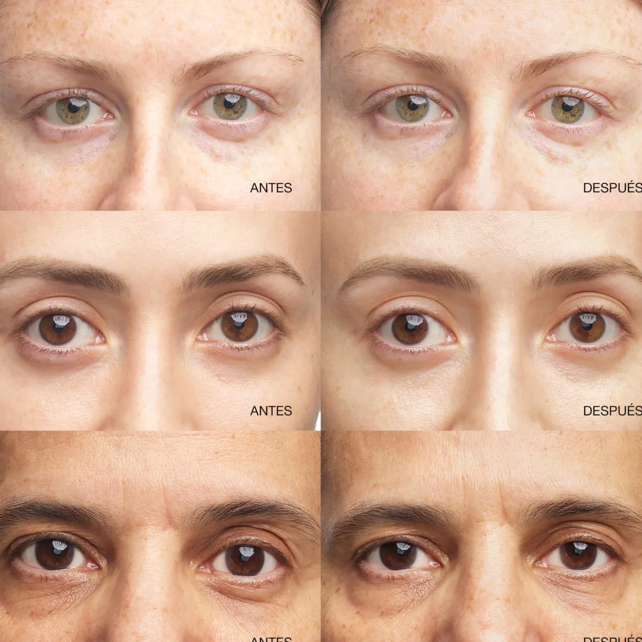 Sérum Concentré Illuminateur pour le Contour des Yeux