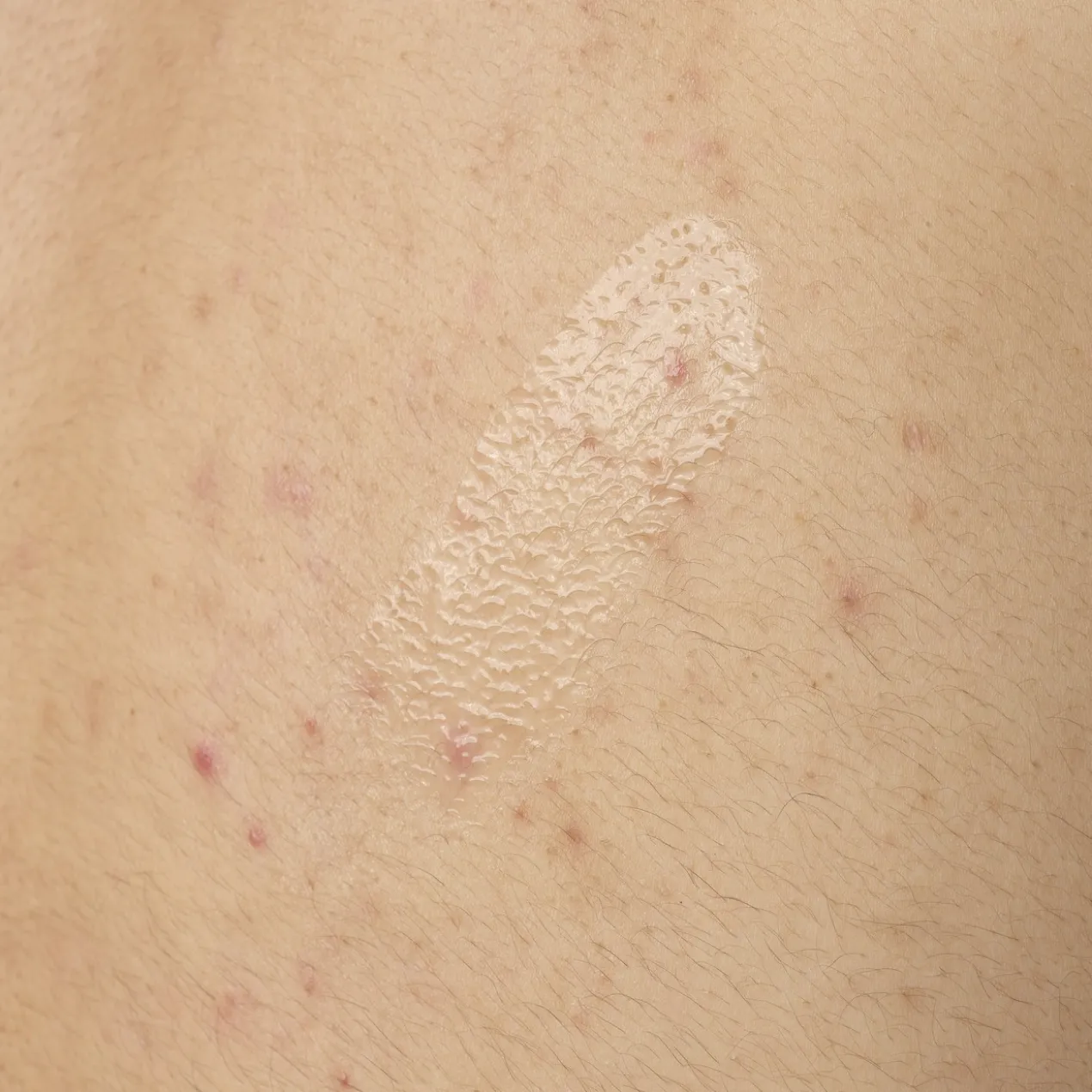 Sérum Corps à l'Acide Salicylique 0,5%