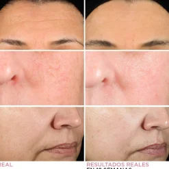 Sérum Crème au Rétinol Hello Results