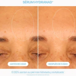 Sérum Hydranad+