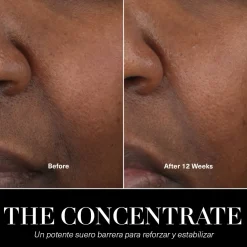 The Concentrate Sérum