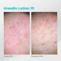 Ureadin Lotion Réhydratante Peau Sèche