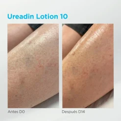 Ureadin Lotion Réhydratante Peau Sèche